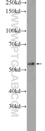 TMEM102 Antibody in Western Blot (WB)