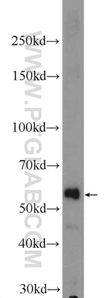 ZNF134 Antibody in Western Blot (WB)