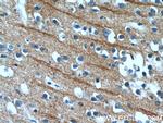 NPB Antibody in Immunohistochemistry (Paraffin) (IHC (P))