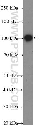 beta Amyloid (C-Terminal) Antibody in Western Blot (WB)