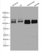 beta Amyloid (C-Terminal) Antibody in Western Blot (WB)