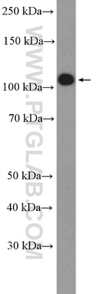 beta Amyloid (C-Terminal) Antibody in Western Blot (WB)