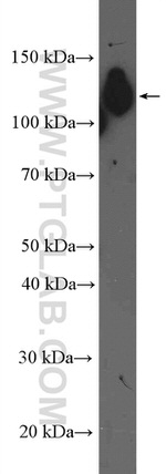 beta Amyloid (C-Terminal) Antibody in Western Blot (WB)