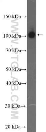 beta Amyloid (C-Terminal) Antibody in Western Blot (WB)