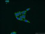 WDR76 Antibody in Immunocytochemistry (ICC/IF)