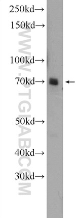 YTHDF3 Antibody in Western Blot (WB)