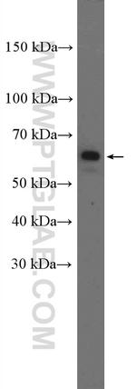 YTHDF3 Antibody in Western Blot (WB)