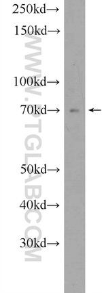 YTHDF3 Antibody in Western Blot (WB)