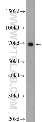 YTHDF3 Antibody in Western Blot (WB)