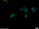 WDR92 Antibody in Immunocytochemistry (ICC/IF)