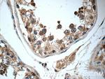 WDR92 Antibody in Immunohistochemistry (Paraffin) (IHC (P))