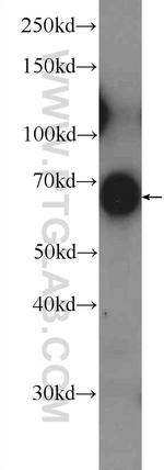 KBTBD10 Antibody in Western Blot (WB)