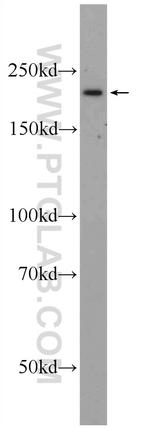 SMCHD1 Antibody in Western Blot (WB)