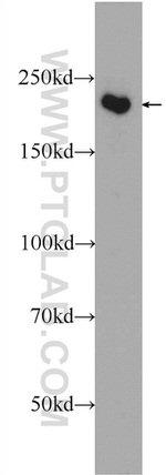 SMCHD1 Antibody in Western Blot (WB)