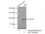 Znt5 Antibody in Immunoprecipitation (IP)