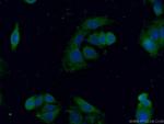 EPHX3 Antibody in Immunocytochemistry (ICC/IF)