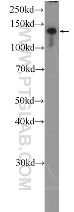 CEBPZ Antibody in Western Blot (WB)