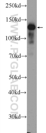 CEBPZ Antibody in Western Blot (WB)