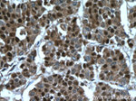 P27/KIP1 Antibody in Immunohistochemistry (Paraffin) (IHC (P))