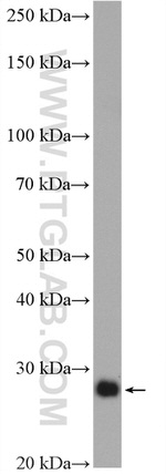 P27/KIP1 Antibody in Western Blot (WB)