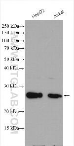 P27/KIP1 Antibody in Western Blot (WB)