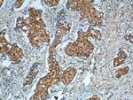 P27/KIP1 Antibody in Immunohistochemistry (Paraffin) (IHC (P))