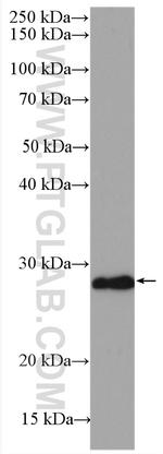 P27/KIP1 Antibody in Western Blot (WB)