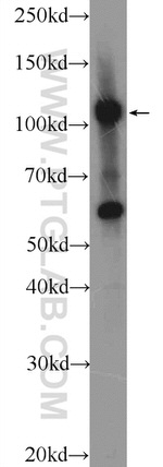 ZC3H7B Antibody in Western Blot (WB)