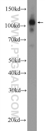 ZC3H7B Antibody in Western Blot (WB)