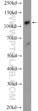 ZC3H7B Antibody in Western Blot (WB)