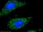 CHCHD3 Antibody in Immunocytochemistry (ICC/IF)