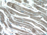 CHCHD3 Antibody in Immunohistochemistry (Paraffin) (IHC (P))