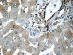 CHCHD3 Antibody in Immunohistochemistry (Paraffin) (IHC (P))