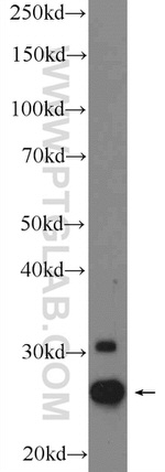 CHCHD3 Antibody in Western Blot (WB)