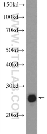 CHCHD3 Antibody in Western Blot (WB)