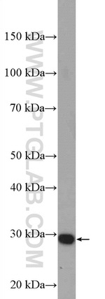 ZCRB1 Antibody in Western Blot (WB)