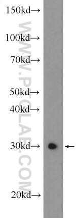 ZCRB1 Antibody in Western Blot (WB)