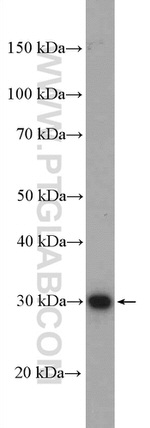 ZCRB1 Antibody in Western Blot (WB)