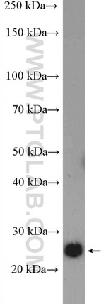 ZCRB1 Antibody in Western Blot (WB)