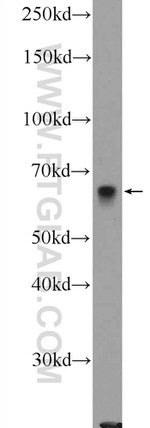 ZBTB22 Antibody in Western Blot (WB)