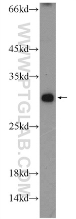 C19orf36 Antibody in Western Blot (WB)