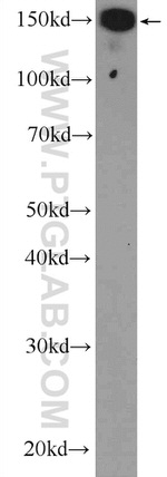 UACA Antibody in Western Blot (WB)