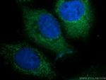 DENND1A Antibody in Immunocytochemistry (ICC/IF)