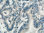 DENND1A Antibody in Immunohistochemistry (Paraffin) (IHC (P))