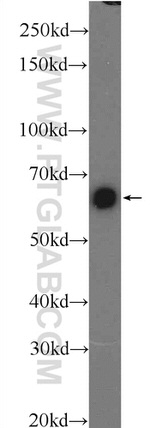 PKM Antibody in Western Blot (WB)