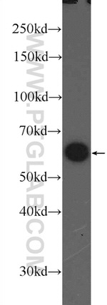 PKM Antibody in Western Blot (WB)