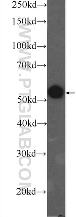 PKM Antibody in Western Blot (WB)