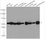 PKM Antibody in Western Blot (WB)