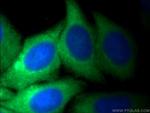 PKM Antibody in Immunocytochemistry (ICC/IF)