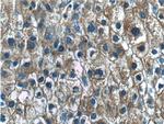 PKM Antibody in Immunohistochemistry (Paraffin) (IHC (P))